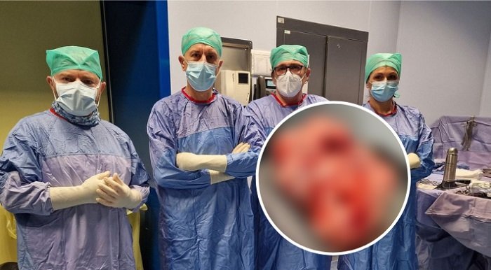 medicos tumores